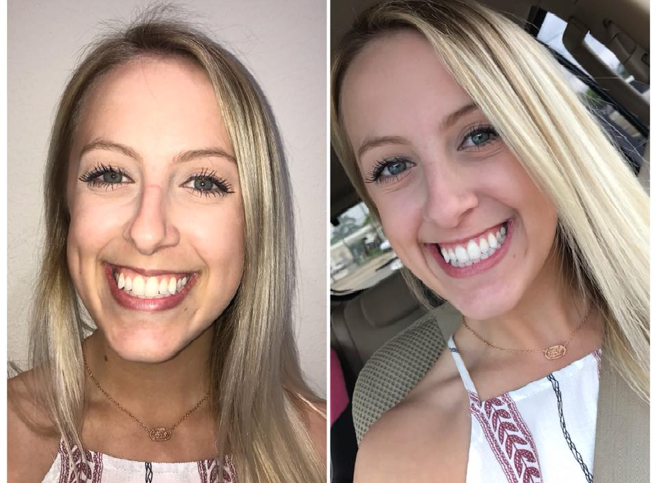 Family & Cosmetic Dentist Beaumont, TX Lumberton Emergency Dentist