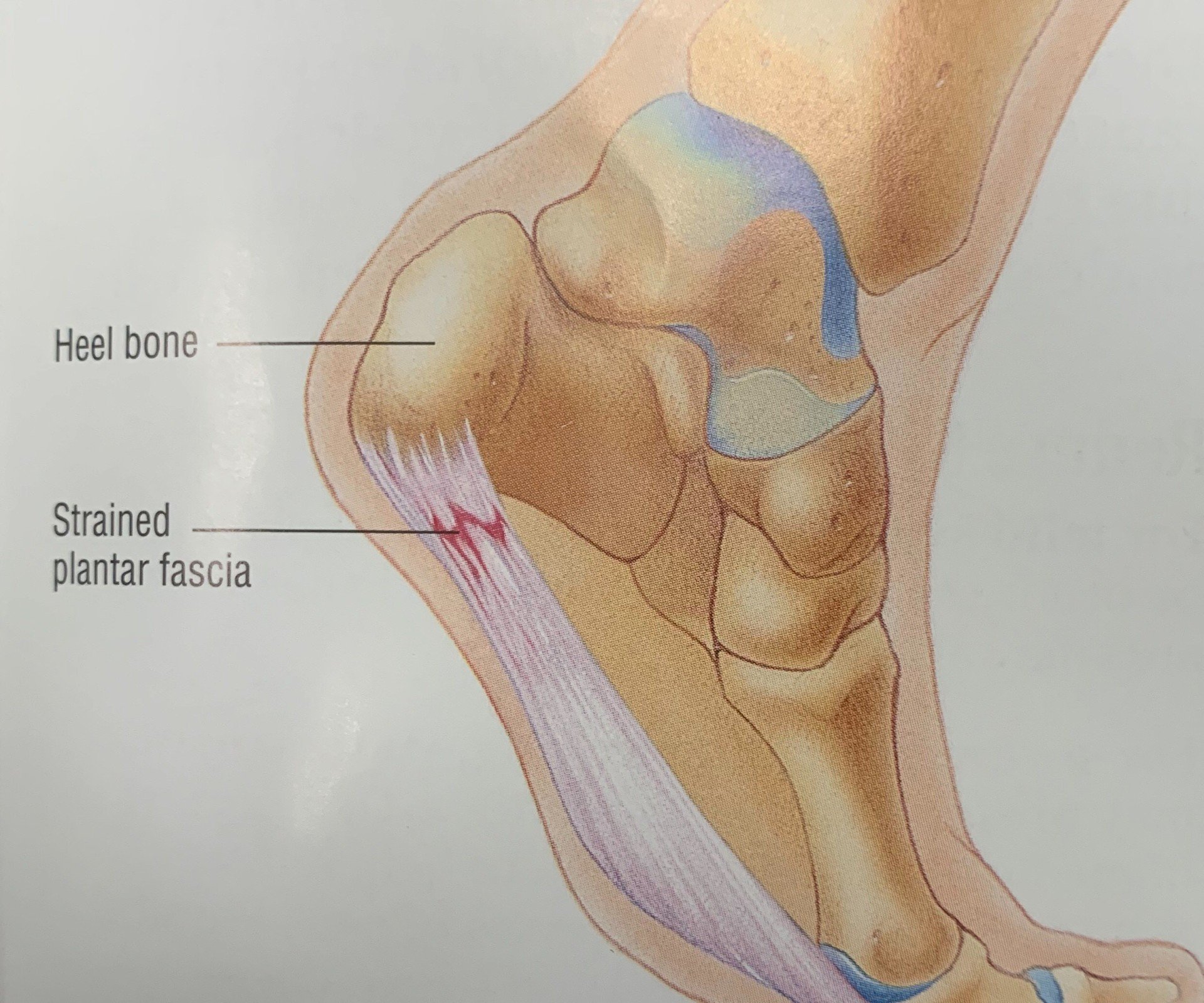 pain in front of heel on inside of foot