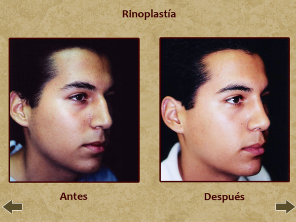 California cosmetic facial surgery Concurrence California cosmetic facial surgery opinion very