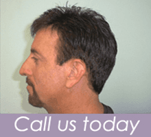 Hair Replacement - Pittsburgh, PA - A Head Of The Times Hair Designs