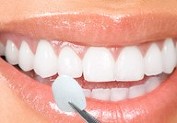 Hatboro, PA Porcelain Veneer Specialist in Hatboro, PA