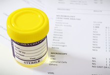 urine