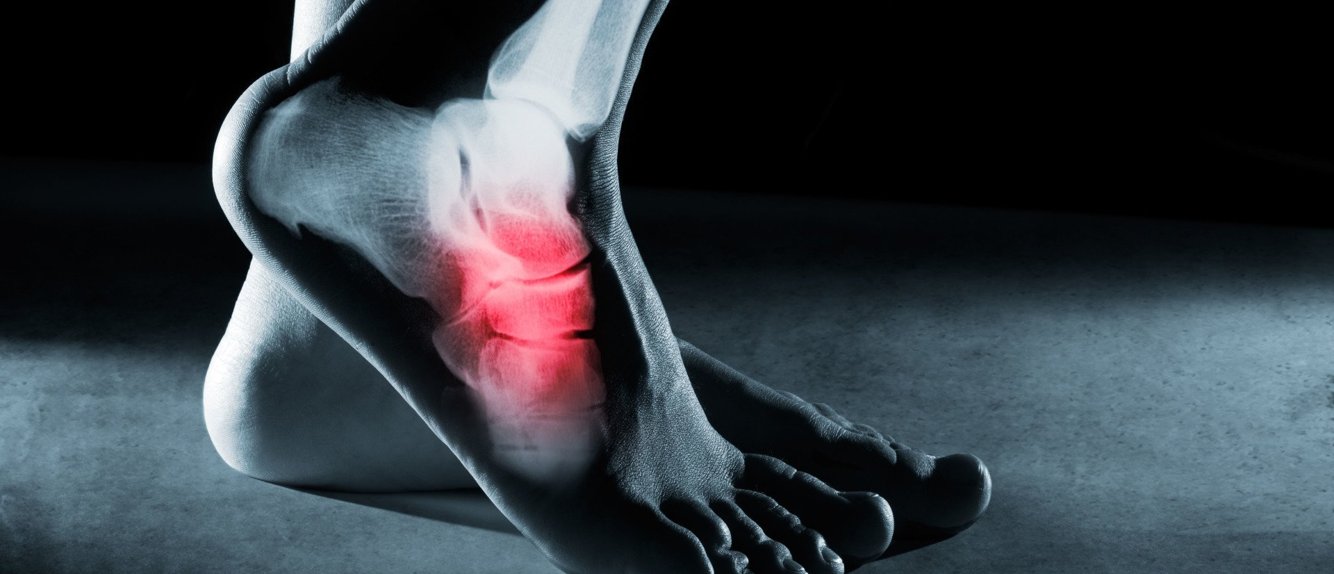 Sports Injuries Treatment Fractures Wyomissing, PA