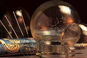 Acupuncture service