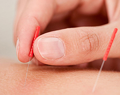 Acupuncture medicine