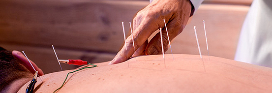 Acupuncture service