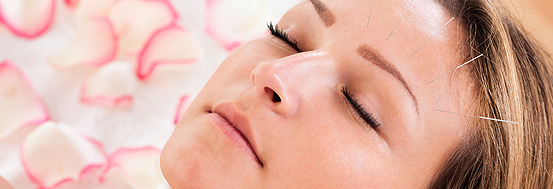 Acupuncture service